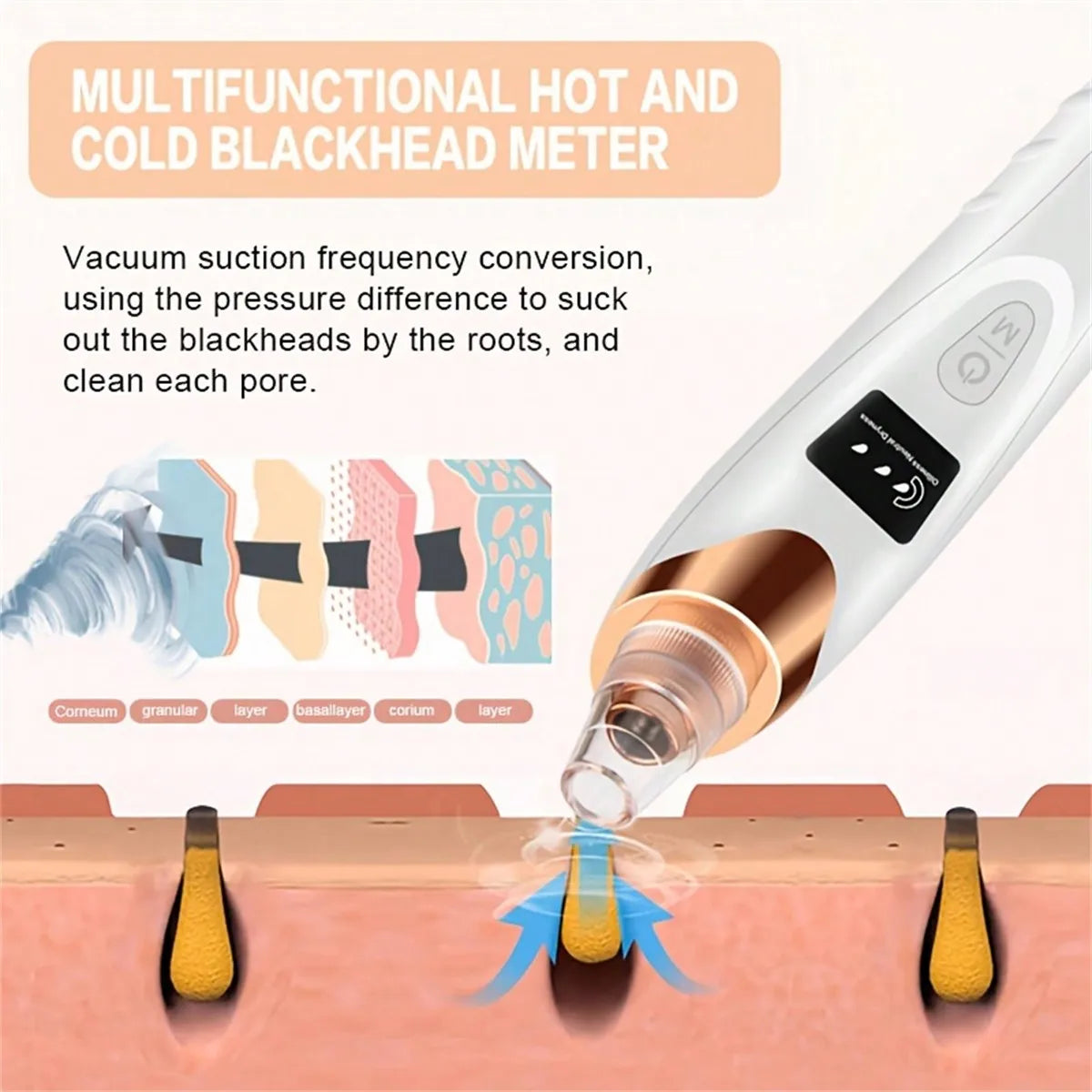 5-Level Suction Pore Vacuum Blackhead Remover – Electric Facial Pore Cleanser Kit for Women & Adults