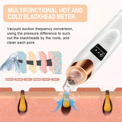 5-Level Suction Pore Vacuum Blackhead Remover – Electric Facial Pore Cleanser Kit for Women & Adults
